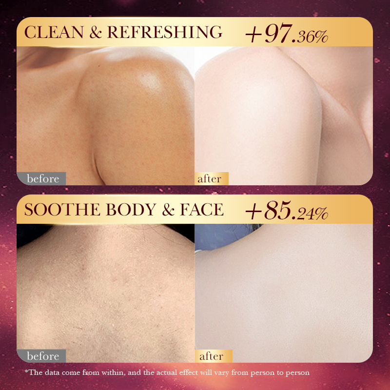 Rose Gold Foil Handmade Soap – - Luxury Skincare Essential review and price